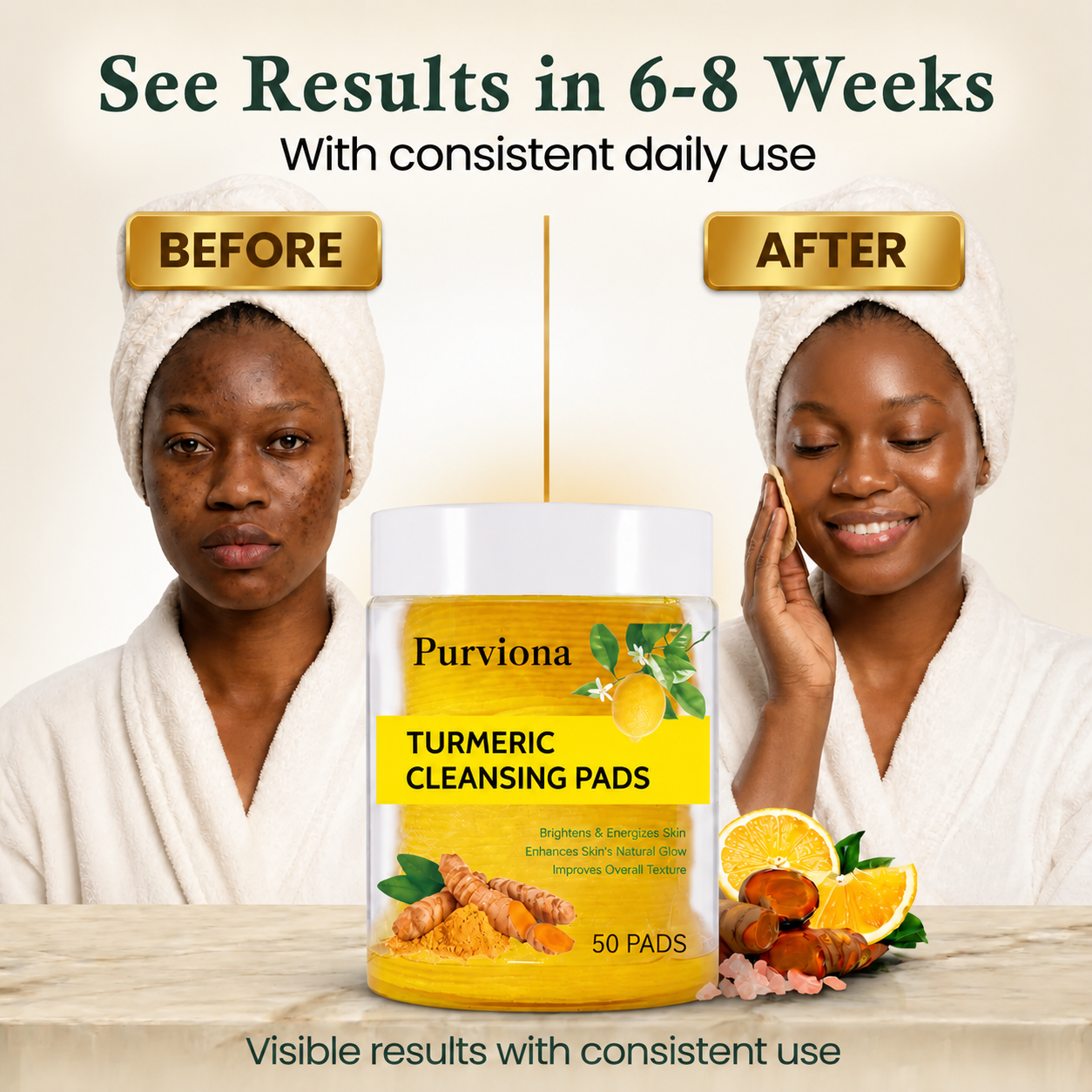 Purviona Turmeric Kojic Acid Cleansing Pads
