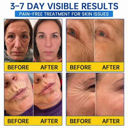 🥈🎁UK HOT SALE Purviona® PDRN Anti-Wrinkle Shot – Lift & Firming Cream
