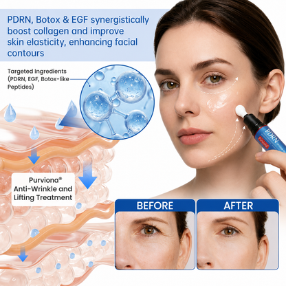 🥈🎁UK HOT SALE Purviona® PDRN Anti-Wrinkle Shot – Lift & Firming Cream
