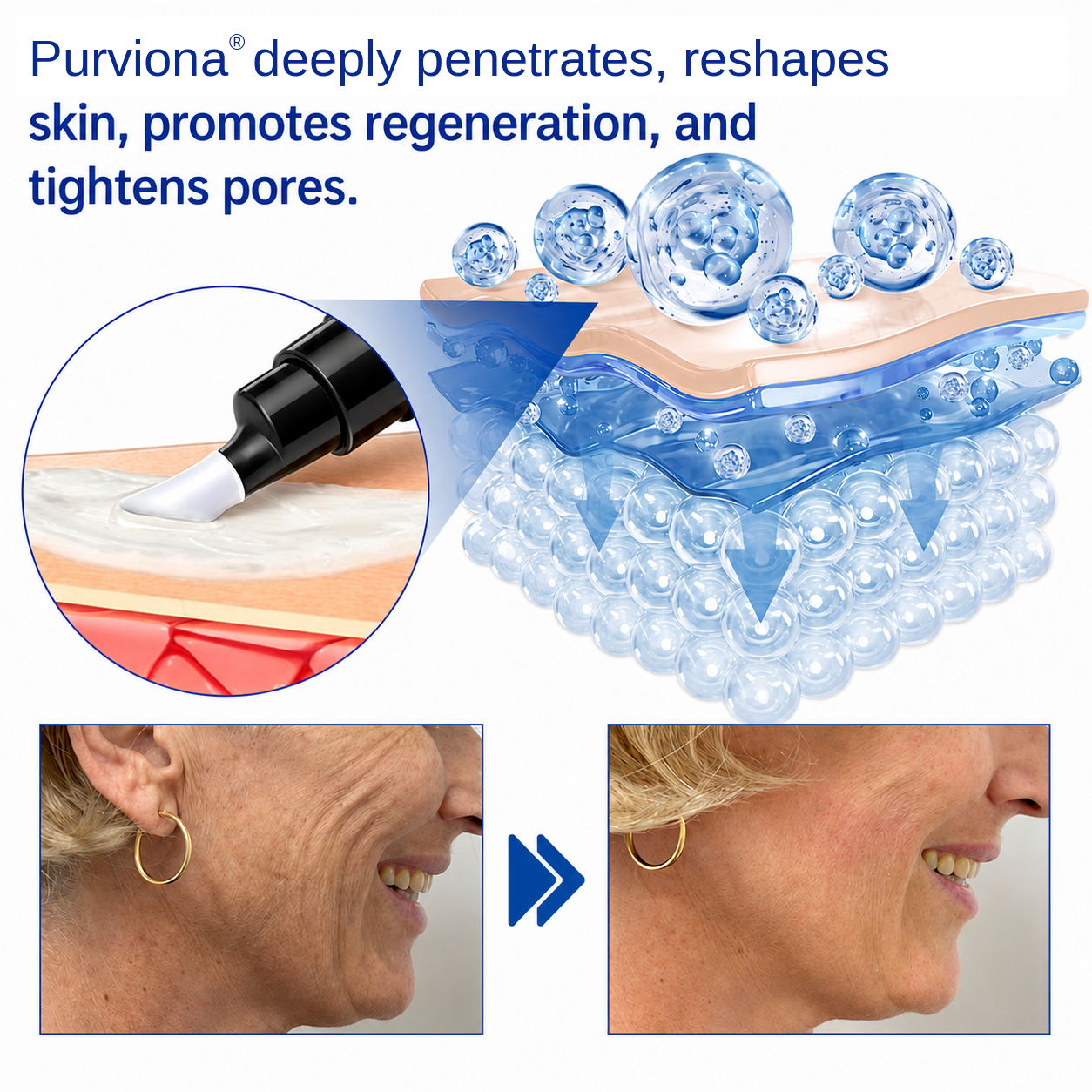 🥈🎁UK HOT SALE Purviona® PDRN Anti-Wrinkle Shot – Lift & Firming Cream