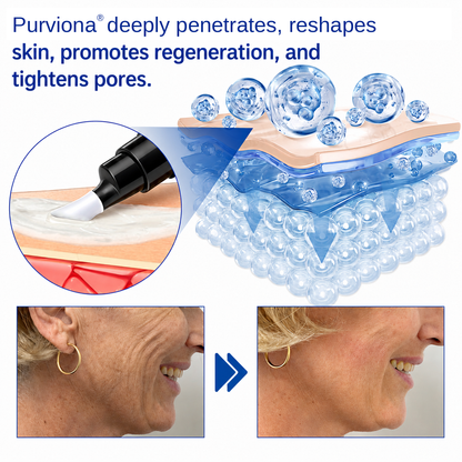 🥈🎁UK HOT SALE Purviona® PDRN Anti-Wrinkle Shot – Lift & Firming Cream