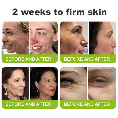 🧠👨‍⚕️Made and shipped from the USA 💫Purviona™ Botin & Vita-A Retinol Shot Wrinkle-Lift Tightening cream - Last Day Promotion 70% OFF